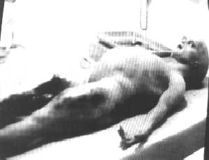 autopsia alieno