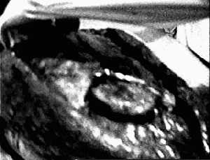 autopsia alieno